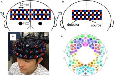 Abnormality of Resting-State Functional Connectivity in Major Depressive Disorder: A Study With Whole-Head Near-Infrared Spectroscopy